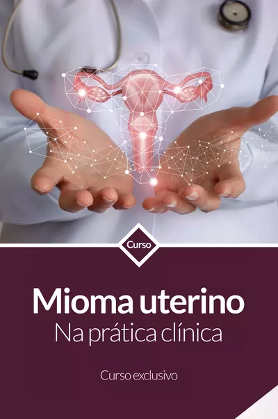 11-ROXO-mioma-uterino