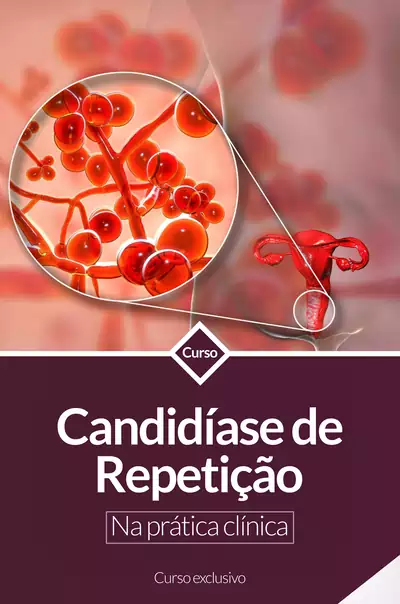 14-ROXO-Candidiase-de-Repeticao